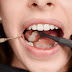 Tooth Enamel - The Dental Health Protector