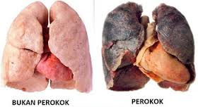 paru-paru perokok