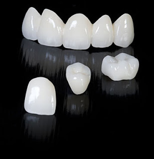 http://crystaldentalcentre.com/crowns