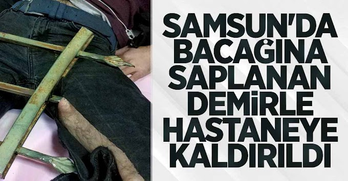 Samsun Merkezde Bacağına Demir Saplandı