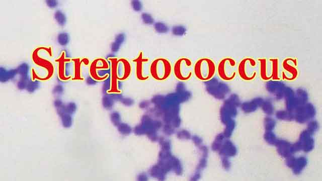 Streptococcus