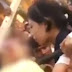 Το πιο φρικιαστικό ατύχημα: Ρόδα λούνα παρκ τής πήρε το σκαλπ για μία selfie (σκληρό βίντεο)