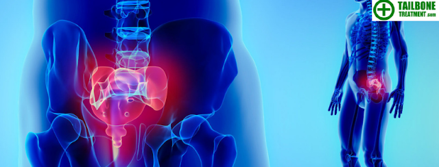 Diagnosis For Tailbone Treatment | Tailbone pain-Sitting X-Ray for Tailbone Treatment