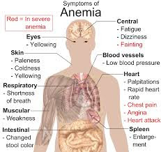 Bagian Tubuh Yang berhubungan dengan anemia