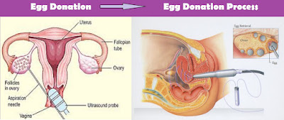 Egg Donor