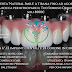 Impianti Dentali a Tirana, 8900€ - 12 impianti e 24 corone in ceramica