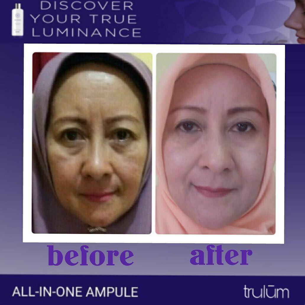 Jual Trulum All In One Ampoule Di Area Teluk Elpaputih, Maluku Tengah WA: 08112338376