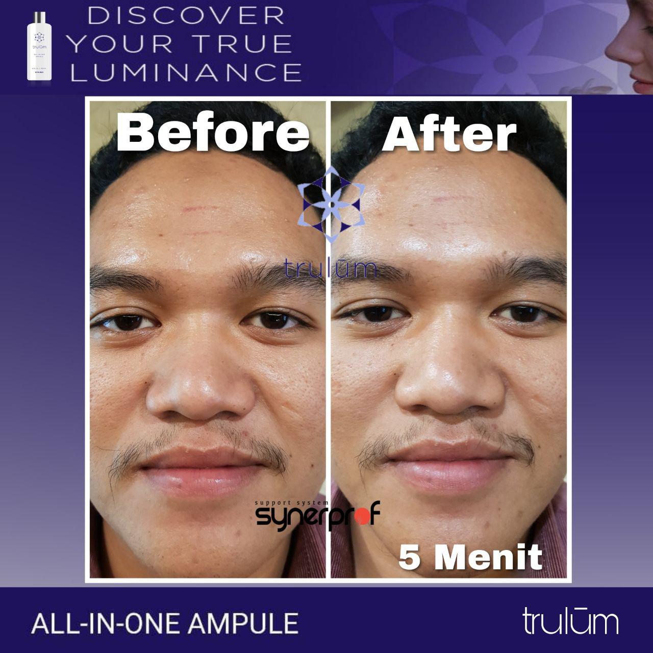 Klinik Kecantikan Trulum Cream Di Wilayah Kakuluk Mesak, Belu WA: 08112338376