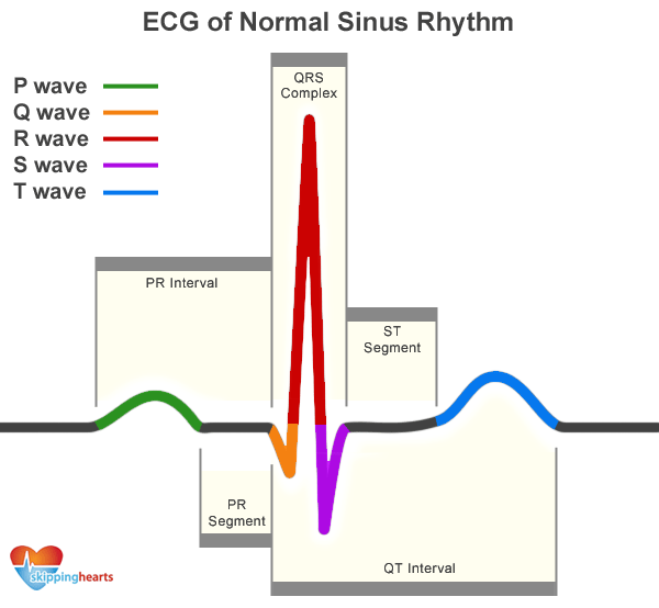 Download 580 Gambar Grafik Ekg Normal Paling Baru HD