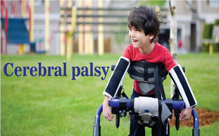 Cerebral Palsy: Causes, Symptoms, and Treatment with Physical Therapy