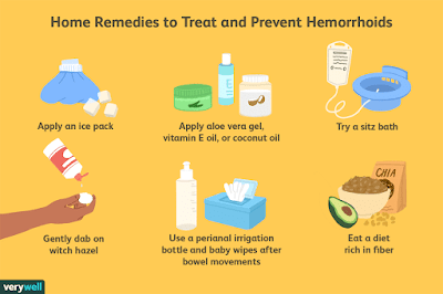 Treating Internal Hemorrhoids