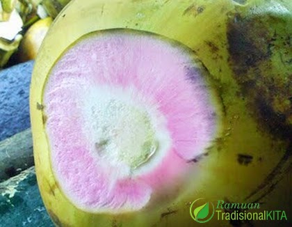 Kencing Batu Sembuhkan dengan Kelapa Hijau