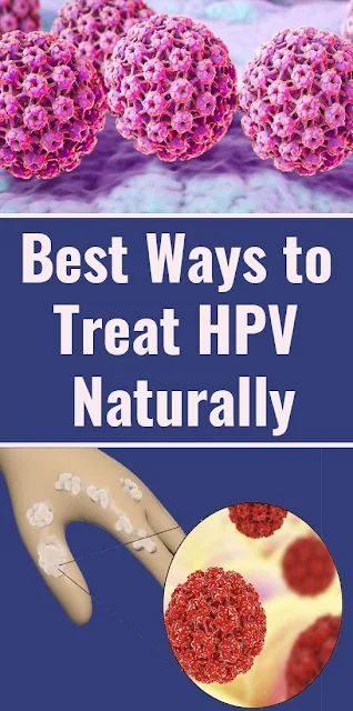 Best Ways To Treat HPV Naturally