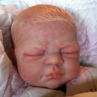 Pimples On 1 Month Old Baby