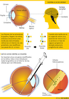 Terapia Genética Ocular