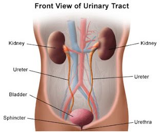 Hyperthermia related to Urinary Tract Infections