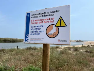 Lo que no hay que hacer si te clavas algo en el pie cuando estás en la playa