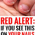 Red Alert: If You See This On Your Nails Immediately Visit A Doctor!