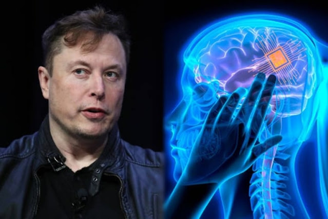 Empresa de Elon Musk abre inscrições para testar chips cerebrais em humanos