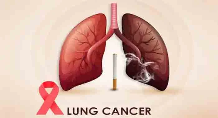 Latest-News, National, Top-Headlines, World-Cancer-Day, Cancer, Health, Smoking, Diseased, Health & Fitness, World Lung Cancer Day 2022, Lung Cancer, World Lung Cancer Day 2022: Why Non-smokers are Getting the Disease?.