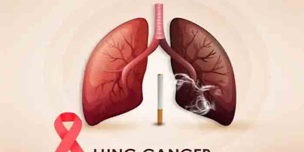 Lung Cancer | ലോക ശ്വാസകോശ അര്‍ബുദ ദിനം: പുകവലിക്കാത്തവര്‍ക്ക് എന്തുകൊണ്ടാണ് ഈ രോഗം വരുന്നത്?