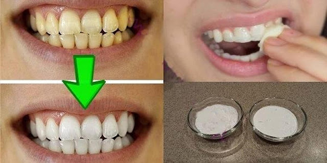 Guaranteed Teeth Whitening In Less Than 2 Minutes!
