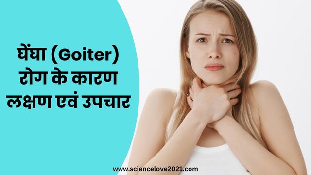घेंघा (Goiter) रोग के कारण लक्षण एवं उपचार | hindi