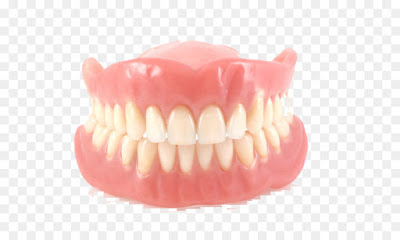 Răng giả tháo lắp bằng nhựa dẻo có ưu điểm gì?