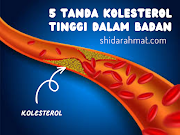 5 Tanda Kolesterol Tinggi Dalam Badan