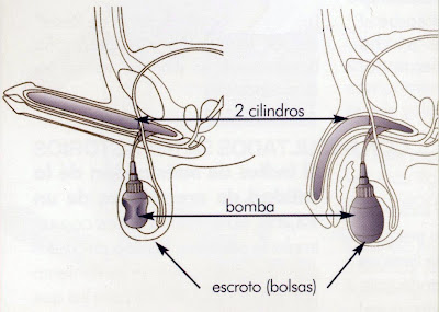 Dibujo de activación-desactivación prótesis de pene Coloplast Excel