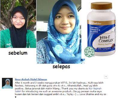 Rawat jerawat dengan Vitamin E Shaklee