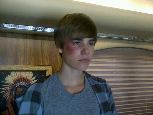 justin bieber on csi. Justin Bieber experienced a