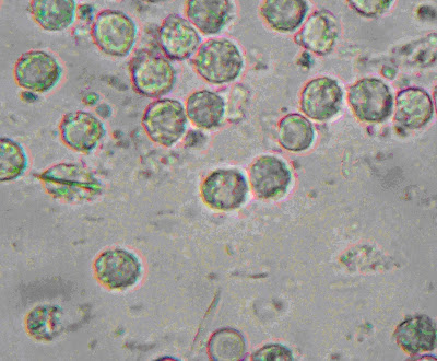 crystalline vs amorphous solids