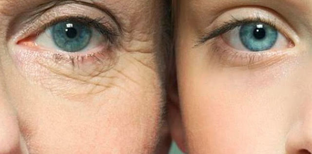 How-to-get-rid-of-Eye-Wrinkles