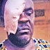 Policeman Battered By Naval Officer Goes Blind
