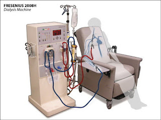 dialysis system price in united states