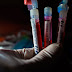 US start first test of an experimental coronavirus vaccine 