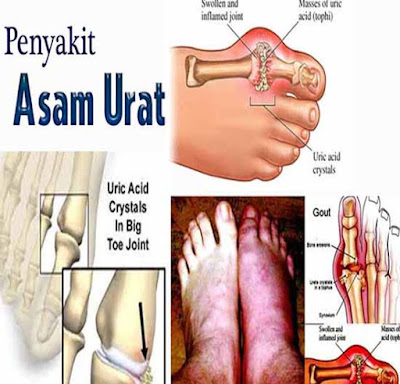 Ketika pohon sirsak jatuh daunnya maka kadang menganggap  55+ Manfaat Daun Sirsak untuk Kesehatan dan Kecantikan Terbaru