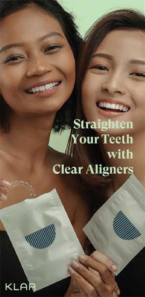 Invisalign Murah Medan Clear Aligner Bening Puri Dental 