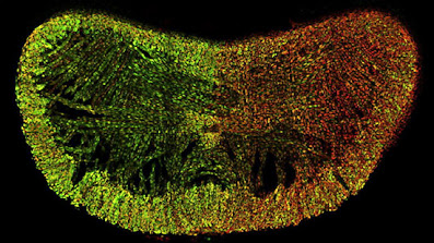 mikroskopia fluorescencyjna