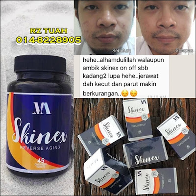 vitamin skinex testimoni