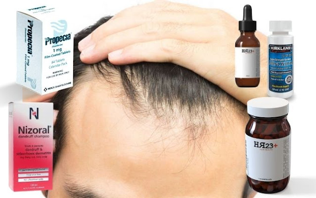 best male hair loss treatment options