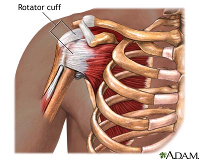 Bodybuilding After Rotator Cuff Injury