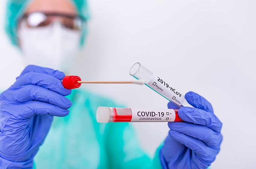 Milhões de falsos positivos para Covid-19 resultando em uma pandemia