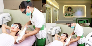 Cara melakukan treatment ZAP