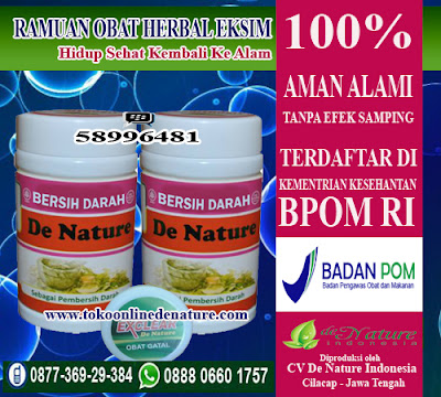 RAMUAN OBAT HERBAL EKSIM