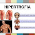 Hipertrofia seletiva