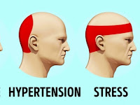  Cara menghilangkan sakit kepala dalam masa 5 minit tanpa makan Panadol !!