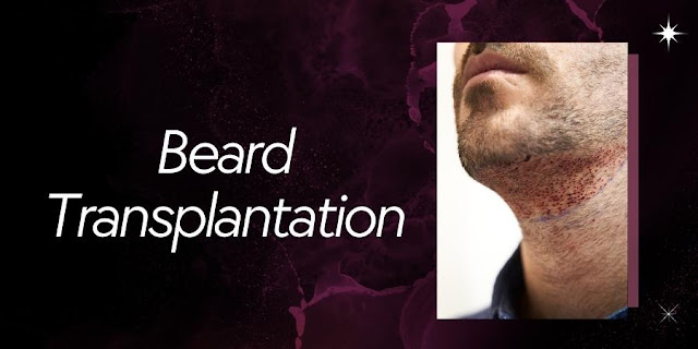 Beard Transplantation