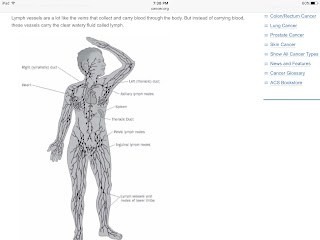   cancer de la lymphe, cancer de la lymphe chance de survie, cancer ganglions lymphatiques chance de survie, cancer lymphatique guerison, cancer de la lymphe stade 4, cancer des ganglions chance de survie, lymphome prise de sang, lymphome stade 4, systeme lymphatique des jambes